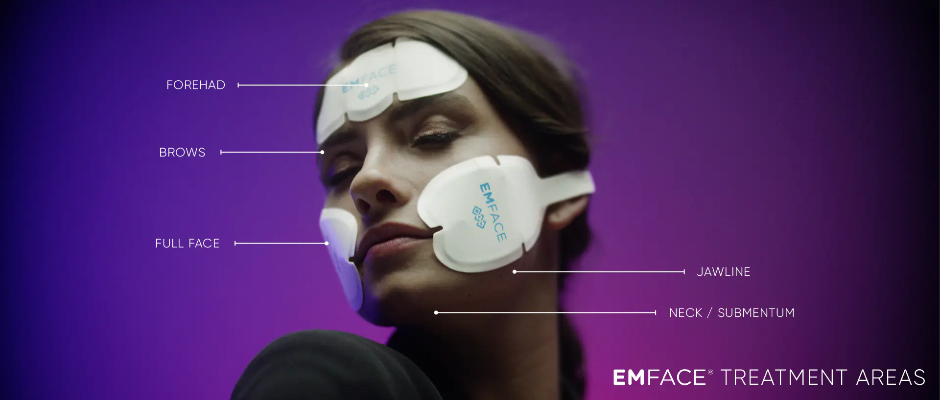 Az EMFACE egy forradalmian új non-invaziv kezelési technológia. Ez a kezelés az arc tonizálásának és feszesítésének egy jövőbe mutató új útját nyitja meg. Az EMFACE a tű-, töltésanyag mentes- és nem sebészi arcszobrászat(kontúrozás) alapjait tette le. Alternatívát nyújt az invazív kezelésekre vagy támogatja és meghosszabítja azok eredményeit.